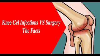 NYC Pain MD Knee Gel Injections vs Surgery Facts [upl. by Ransom]