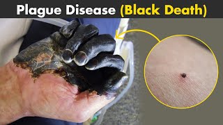 Plague  Black Death  Symptoms Causes And Treatment UrduHindi [upl. by Eilsehc183]