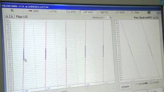 Volúmenes Pulmonares por Pletismografía corporal Prueba [upl. by Enylecoj959]