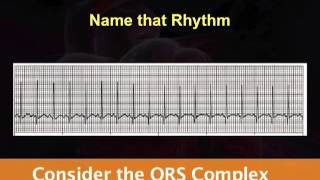 EKG Basics  Part 2 of 3 [upl. by Opal353]