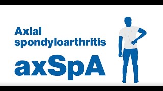 More than just back pain what is Axial Spondyloarthritis axSpA [upl. by Sena237]