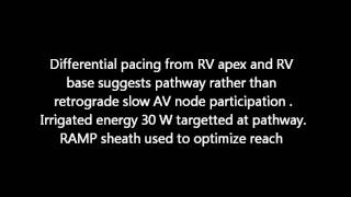 PJRT  Permanent Junctional Reciprocating Tachycardia [upl. by Tterag]