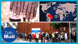 Monkeypox UK People queue outside London hospital for monkeypox vaccinations [upl. by Padget263]