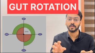 Gut Rotation Anatomy Malayalam LectureOmphalocele [upl. by Bohlin]