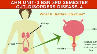 AHN BSN 3rdsemester Unit3 GUT Disorders Disease No4 Urethral structureshydrophorosishydroureter [upl. by Nikolas]