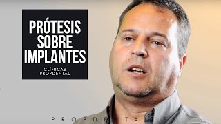 Implantes dentales el testimonio del Sr Carlos [upl. by Aneis928]