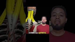 Dolor cervical dolorcervical cuello puebla a a anatomia greenscreen dolorcronico anatomy [upl. by Evey251]