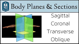 EASY TRICKS for Anatomical Body Planes and Sections DirectionPosition [upl. by Lustig]