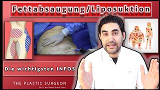 Die wichtigen Infos zur Fettabsaugung Liposuktion  Dr Alawi [upl. by Leahcimaj]