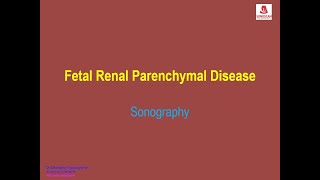 Fetal Renal Parenchymal Disease [upl. by Anwahsal]