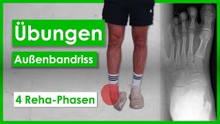 Bänderriss im Sprunggelenk⎮4 PhasenAnleitung⎮Übungen [upl. by Delilah]