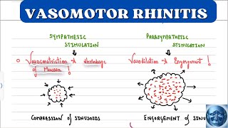 ENT 🔥II VASOMOTOR RHINITIS II RHINITIS MEDICAMENTOSA II NONALLERGIC RHINITIS II EASY EXPLANATION I [upl. by Gelya]