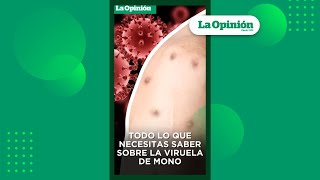 Viruela del mono ¿Cómo se contagia la mpox  La Opinión [upl. by Hafital]