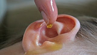 Natural Remedies for Ear Infection [upl. by Vittorio]