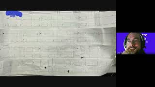 Academia Electrocardiovisión Clase 0 [upl. by Megan538]