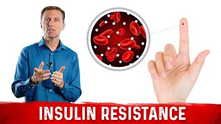 Understanding Insulin Resistance amp What You Can Do About It – DrBerg [upl. by Irihs]