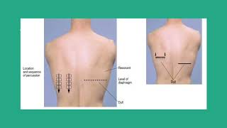 CARDIOPULMONARY ASSESSMENT CHEST EXPANSION MEASUREMENT amp DIAPHRAGMATIC EXCURSION [upl. by Rakso]