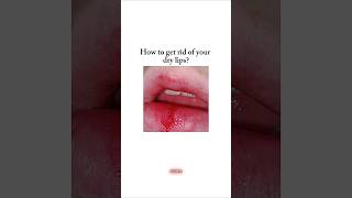 How to get rid of dry lips 🎀 fyp shorts viral viralshorts kpop bts aesthetic beauty [upl. by Llacam]