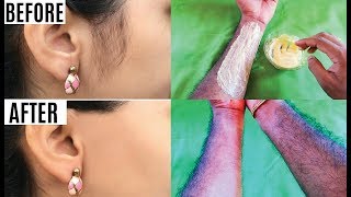 അനാവശ്യ രോമം കളയാം പോയ രോമം തിരികെ വരില്ല How to Remove Facial Hair permanently at home [upl. by Carolyn154]