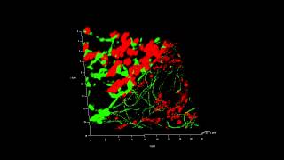 GSD 3D versus Epifluorescence COS Cell [upl. by Berry]