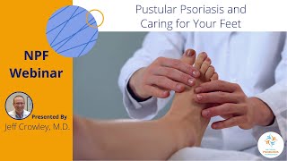 Pustular Psoriasis and Caring for Your Feet [upl. by Llehcram]