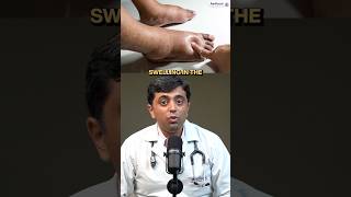 What are your swollen legs telling you [upl. by Phi]