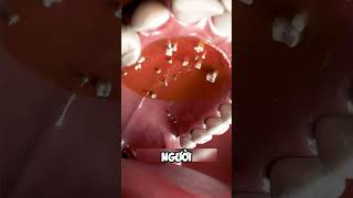 Hyperdontia bạn đã biết chưa dentist facts nhakhoa teeth [upl. by Faustine]