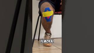 Effective Taping Strategies for Patellofemoral Pain Relief physiotherapy [upl. by Quirita]