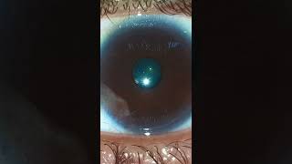 My eye pupil contracting and dilating iris eye pupil science biology body human intraocular [upl. by Aerdua894]