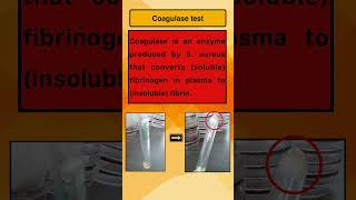 Coagulase test [upl. by Leeanne]