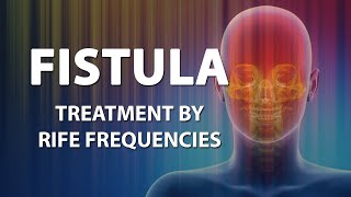 Fistula  RIFE Frequencies Treatment  Energy amp Quantum Medicine with Bioresonance [upl. by Carolina]