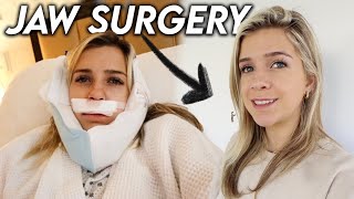 My Jaw Surgery Experience  Before amp After 3 Months Post Op [upl. by Aivitnahs]