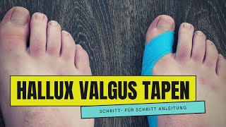 HALLUX VALGUS tapen  So einfach geht es [upl. by Ullman]