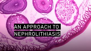 An approach to nephrolithiasis [upl. by Eimirej489]