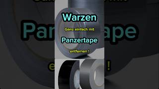 Warzen mit Panzertape entfernen gesundheit tips diy beauty fyp haut fürdich [upl. by Abihsat812]