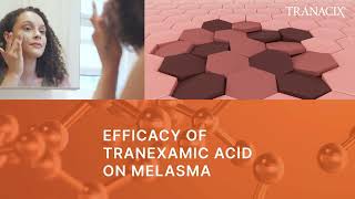 TREATMENT OF MELASMA  TRANACIX® Cream  Medical Spot [upl. by Wilhelm]