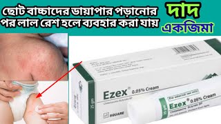 ezex cream এর কাজ কিদাদ একজিমা বাচ্চাদের ঘামাচির মত গোটা বা লাল রেশ হলে [upl. by Croix]