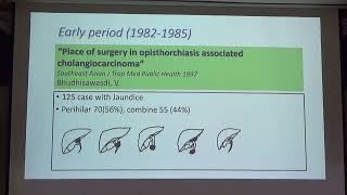 Cholangiocarcinoma  Past Present Future [upl. by Allyce]