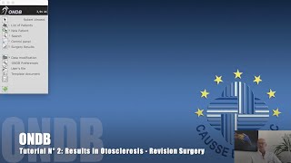 The OtologyNeurotology Database ONDB ©  Tutorial N° 2  Results  Otosclerosis Revision Surgery [upl. by Amat]