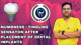 Dr Rudra Mohan  Neurosensory Disturbances After Dental Implant Placement  Numblness  Tingling [upl. by Crompton567]