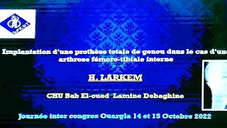 Implantation dune prothèse totale de genou dans le cas dune arthrose fémoro tibiale interne [upl. by Fogg]