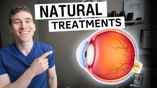 5 NATURAL Ways to Prevent And Treat Macular Degeneration [upl. by Aila918]