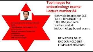 Top Images for Endocrinology exams SCE EBEEDM MRCPUKFree view [upl. by Aisela]