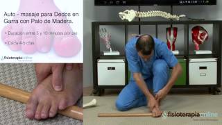 Tratamiento para los dedos en garra  Fisioterapia Bilbao [upl. by Renrew]