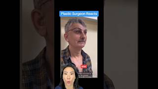 😬BROW LIFT GONE WRONG Surgeon Reacts [upl. by Bilek]