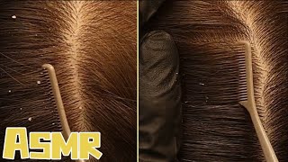 🎧ASMR｜Immerse in scalp care and clean head hygiene [upl. by Sinylg]