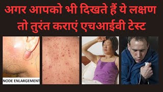 एचआईवी के शुरुआती लक्षण । HIV Ke Lakshan। HIV Symptoms Male amp Female। AIDS lakshan । By Pathology। [upl. by Nnodnarb820]