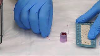 How to Measure the Hematocrit [upl. by Airahs]