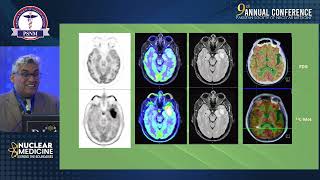 PSNM 2024  Trailblazing Trends of Nuclear Medicine Future Expectation amp Reality  Arif Shaikh USA [upl. by Anirpas]