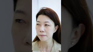 Effective Wrinkle amp Pore Reduction Treatment  Victoria Facelift Review [upl. by Kirkwood]